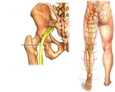 bol i slabost u zglobu koljena